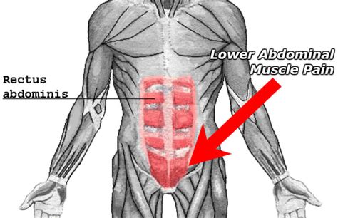 torn muscles in abdomen